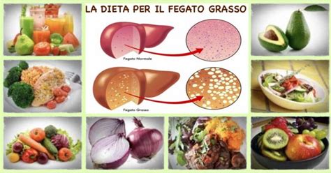 Alimentazione per il fegato grasso