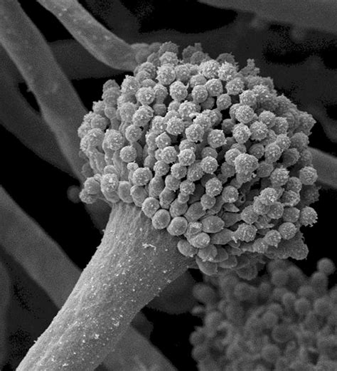 Aspergillus fumigatus
