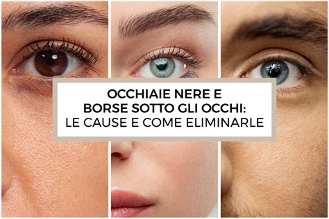 Burrocacao e Occhiaie