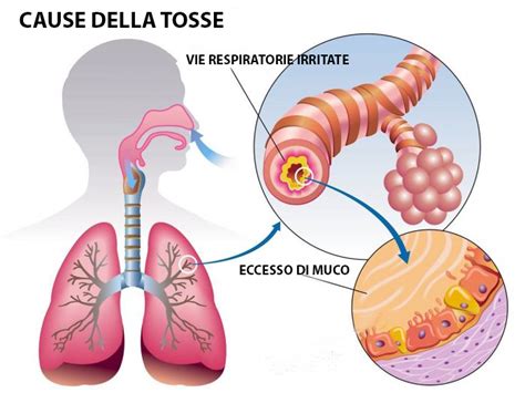 Cause della tosse