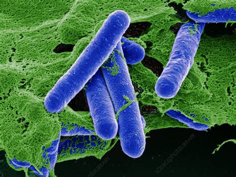 Clostridium Botulinum