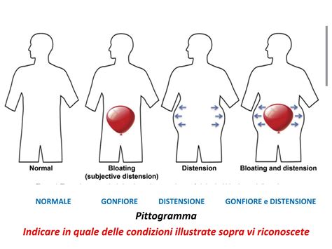 Distensione addominale