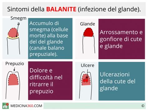 Infiammazione del glande
