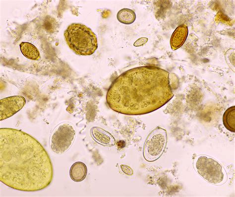 Parassiti Intestinali