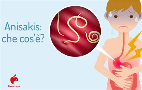 Prevenzione Anisakis