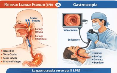 Reflusso Laringofaringeo e Cioccolato