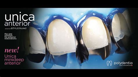 Ricostruzione dentale con matrici Unica anterior