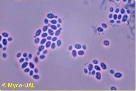 Saccharomyces cerevisiae al microscopio