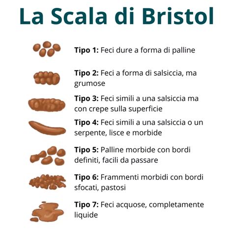 Scala di Bristol