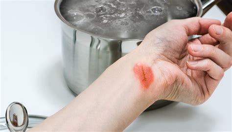 Scottatura in padella