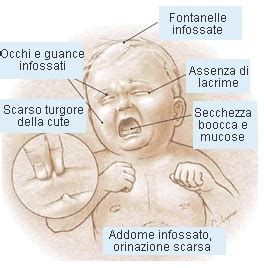 Segni di disidratazione nei bambini