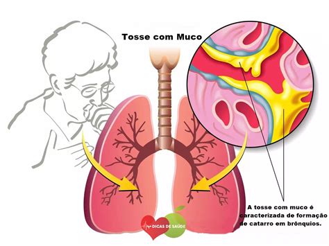 Tosse e muco