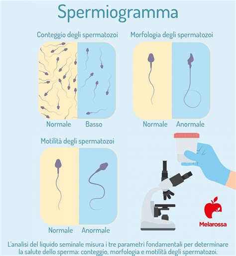preparazione spermiogramma